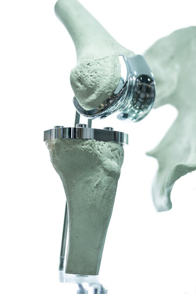 3D протез колена для медицины
