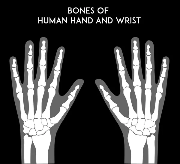 Huesos de manos y muñecas humanas — Archivo Imágenes Vectoriales