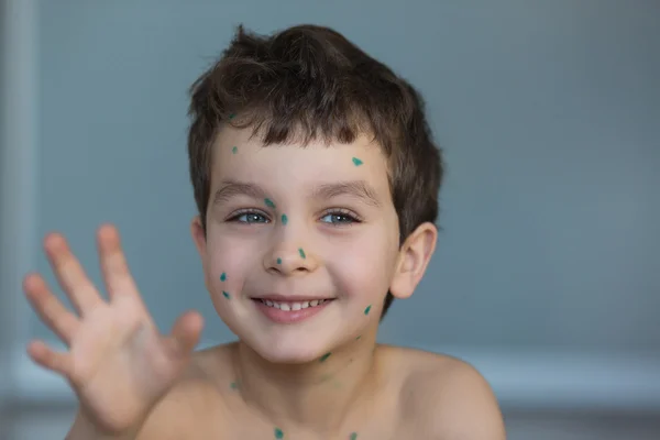 Портрет смішного маленького хлопчика з зеленими крапками — стокове фото