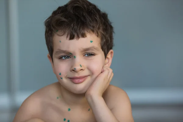 Портрет сумного маленького хлопчика з зеленими точками на його обличчі — стокове фото
