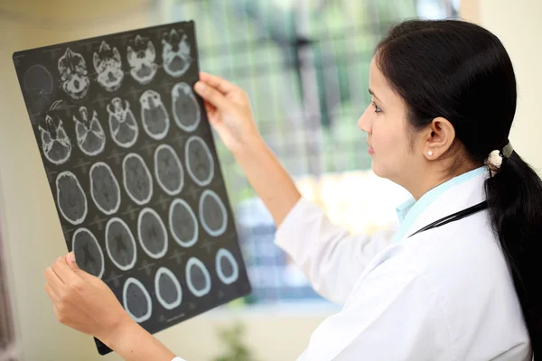 Kvinnliga läkare undersöka en datortomografi hjärna Skanna — Stockfoto