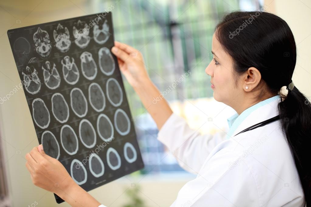 Female doctor examining a brain computerized tomography scan