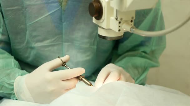 Chirurgie oog, lens, spuit, invoeren van de lens — Stockvideo