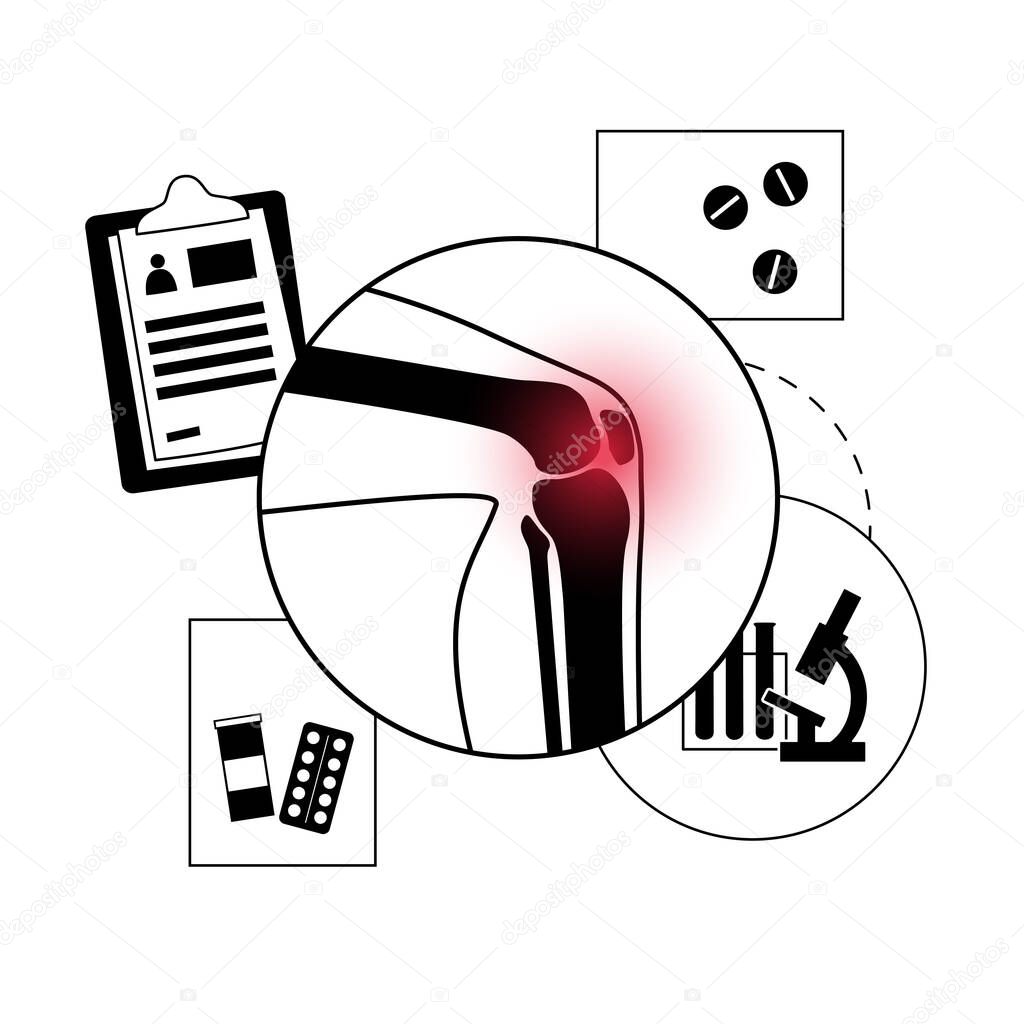 Arthritis knee joint banner. Rheumatoid arthritis clinic logo. Pain in leg. Human bone anatomy flat vector illustration. Skeleton x ray scan concept. Painful injury and erosion on medical poster.