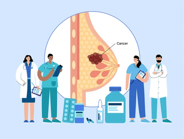 유방암 개념 — 스톡 벡터