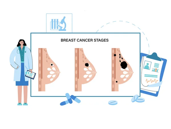 유방암 개념 — 스톡 벡터