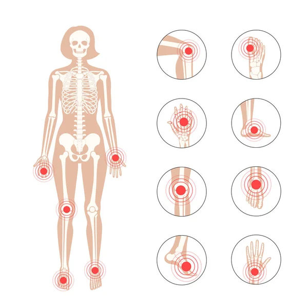 Concepto de huesos normales — Vector de stock