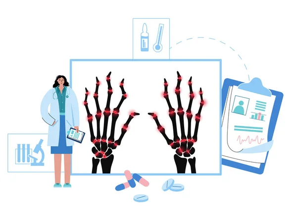Artritida plakát koncept — Stockový vektor