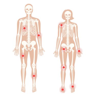 Normal kemik kavramı