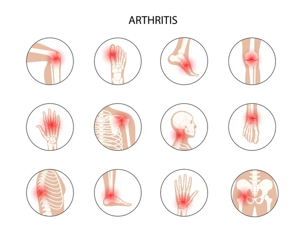 Concepto de huesos humanos — Vector de stock