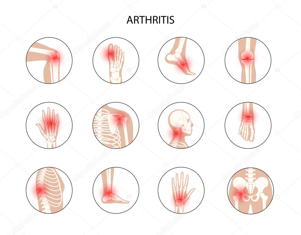 Human bones concept