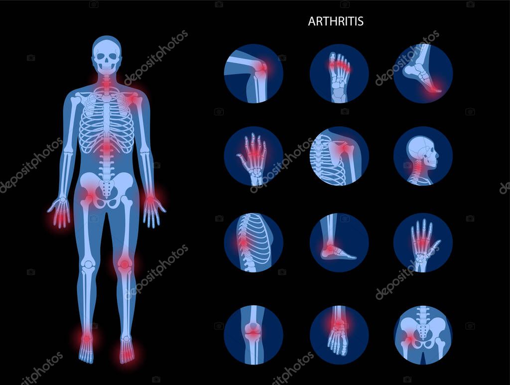 Pain in male human body. Man skeleton silhouette. Spine, knee, other joint icons. Arthritis, inflammation, fracture, bone structure and cartilage concept. Medical poster. Flat xray vector illustration