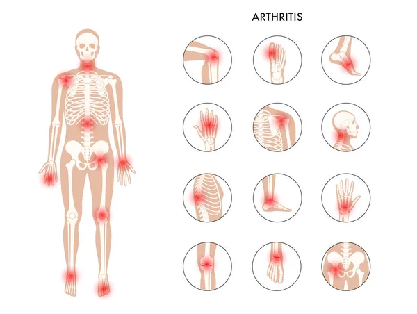 Concepto de huesos humanos — Vector de stock