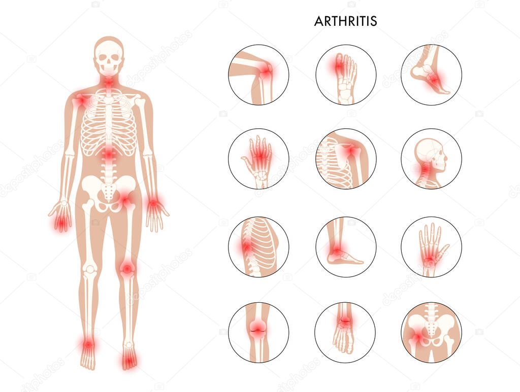 Pain in human body. Male skeleton silhouette. Spine, knee and other joint icons. Arthritis, inflammation, fracture, bone structure and cartilage concept. Medical poster. Flat xray vector illustration