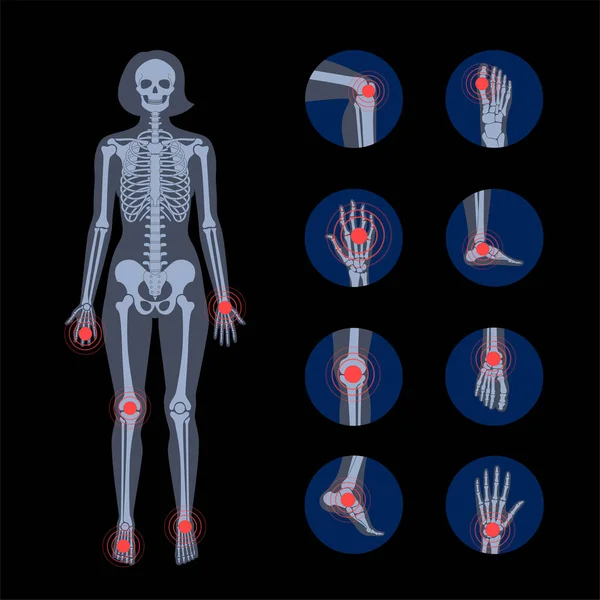 Concepto de huesos humanos — Vector de stock