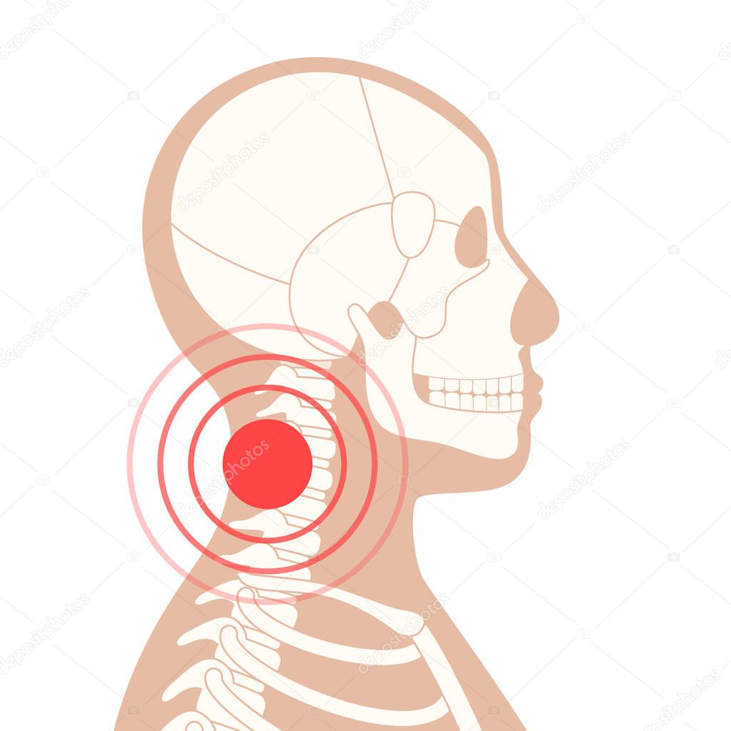 Pain in neck or spine bones. Skeleton x ray silhouette medical poster. Joints and cartilage in human body concept. Rheumatoid arthritis, inflammation, backbone disease concept flat vector illustration