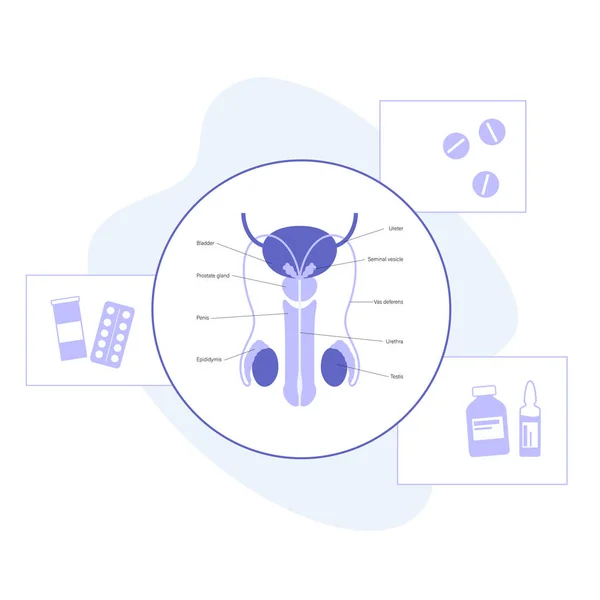 Problemas do sistema reprodutivo do homem — Vetor de Stock