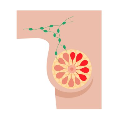 Göğüs hastalığı konsepti