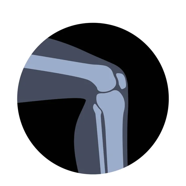 Menschliche normale Knochen — Stockvektor
