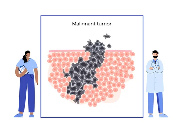 Tumor cells concept — Stock Vector