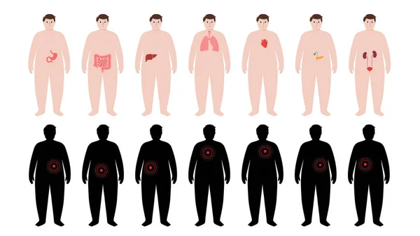 Órganos en el cuerpo humano obeso — Vector de stock