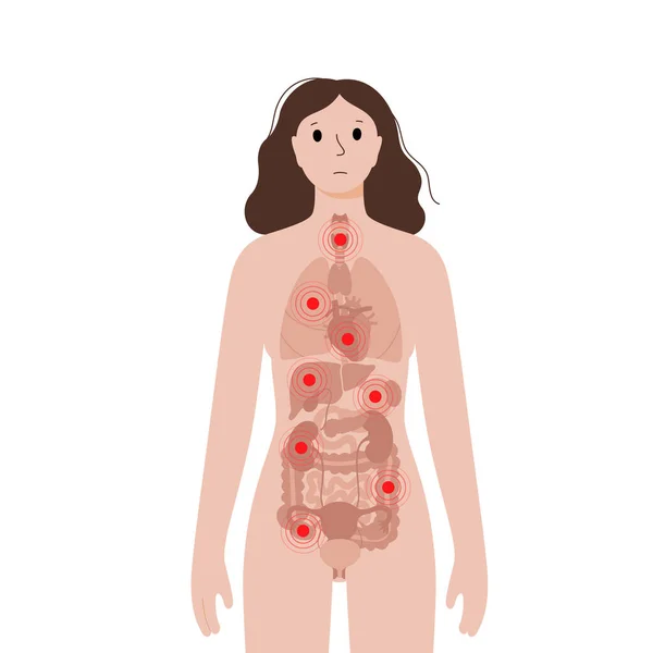 Dolor en el cuerpo de la mujer — Vector de stock