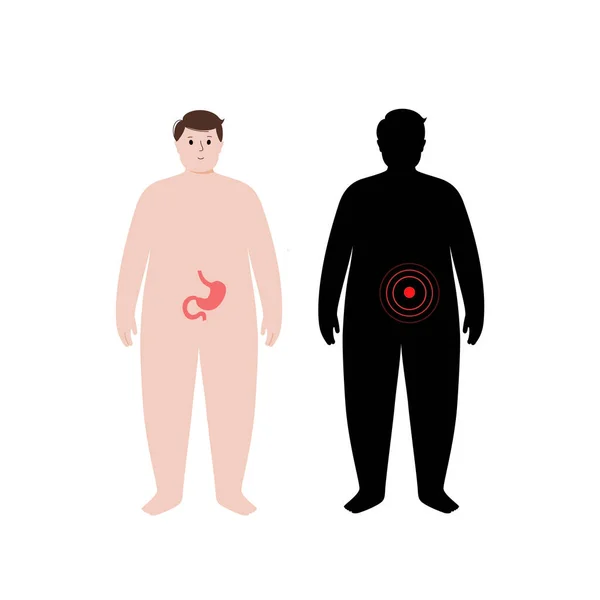 Organ dalam tubuh manusia obesitas - Stok Vektor