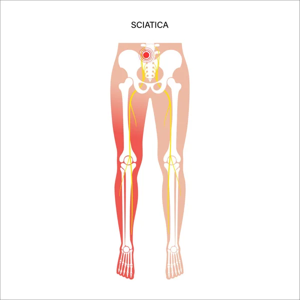 Кости и мышцы таза — стоковый вектор