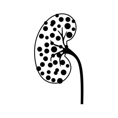 Böbrek hastalığı konsepti