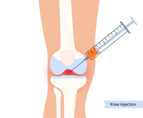 Konzept der Knieinjektion — Stockvektor