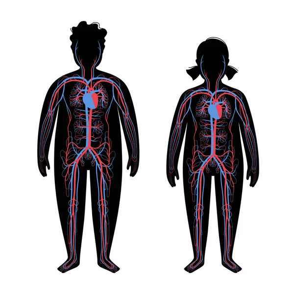 Sistema sanguíneo en el cuerpo obeso — Archivo Imágenes Vectoriales