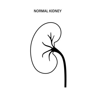 Böbrek hastalığı konsepti