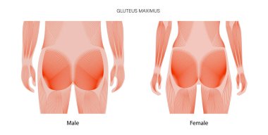 Kaslı sırt kavramı