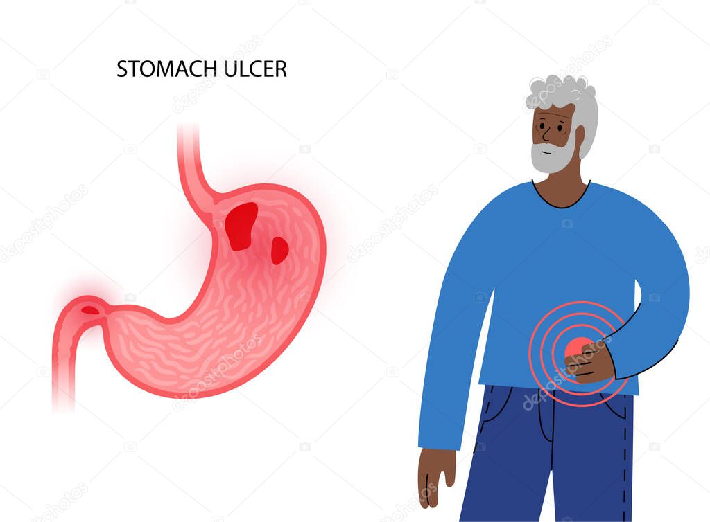 Stomach ulcer concept