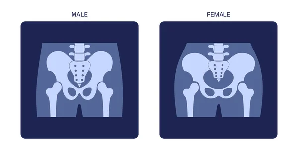 Radiografía de la pelvis muscular — Archivo Imágenes Vectoriales