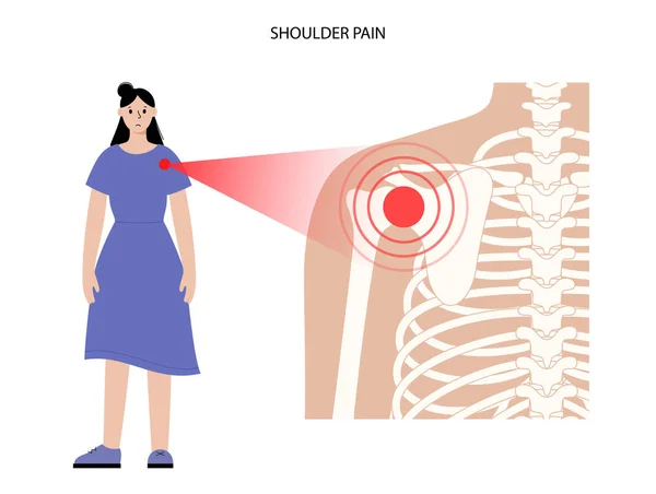 肩痛的概念 — 图库矢量图片