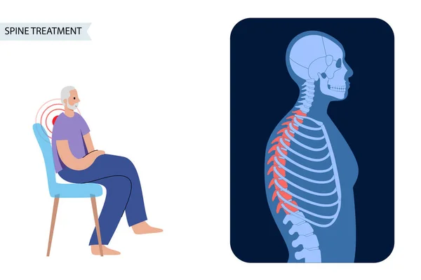 脊柱侧弯和脊柱疼痛 — 图库矢量图片