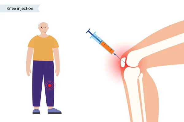 膝关节注射X光 — 图库矢量图片