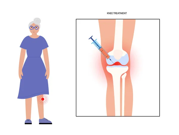 Concepto de inyección de rodilla — Archivo Imágenes Vectoriales