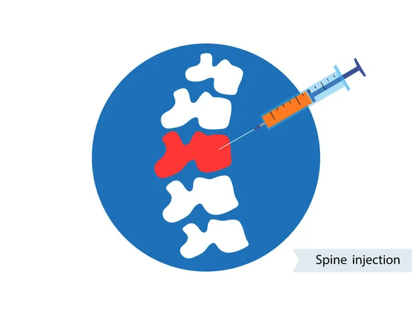 Injection articulaire colonne vertébrale — Image vectorielle