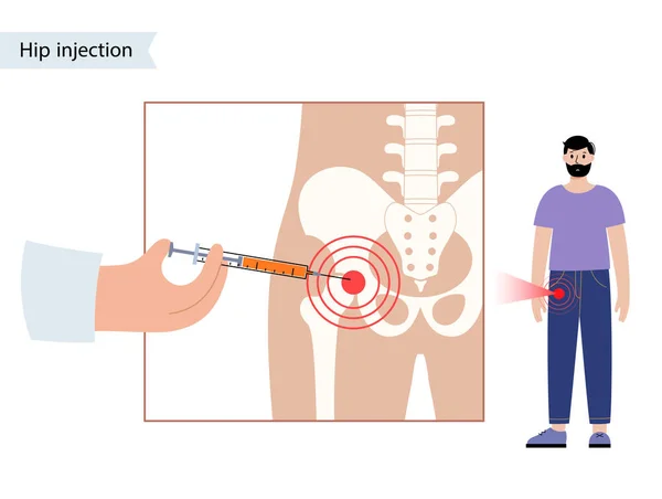 Kalça eklemi enjeksiyonu — Stok Vektör