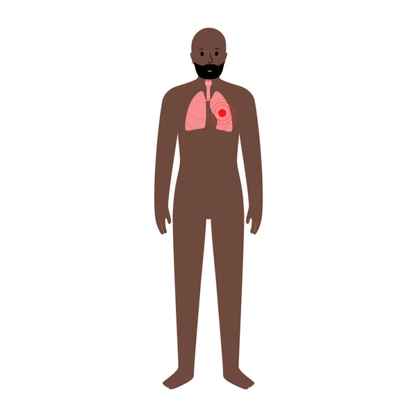 남성 신체의 통증 — 스톡 벡터