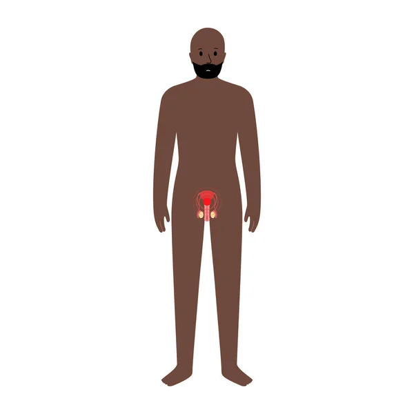 Smärta i manlig kropp — Stock vektor