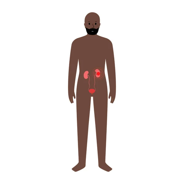 Dolore nel corpo maschile — Vettoriale Stock