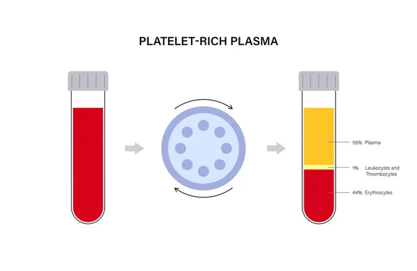 Conceito de plasma rico em plaquetas — Vetor de Stock