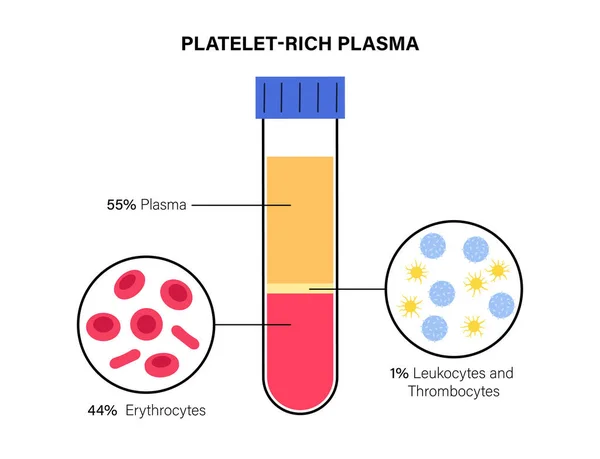 Concepto de plasma rico en plaquetas — Vector de stock