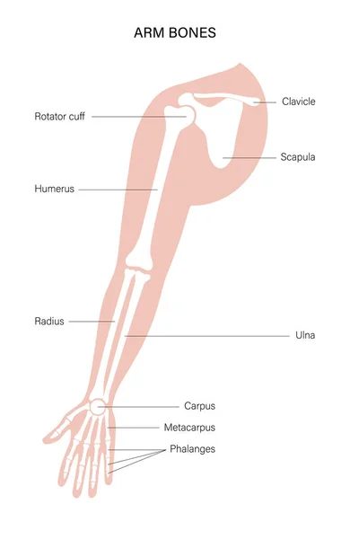 Cartel huesos del brazo — Archivo Imágenes Vectoriales