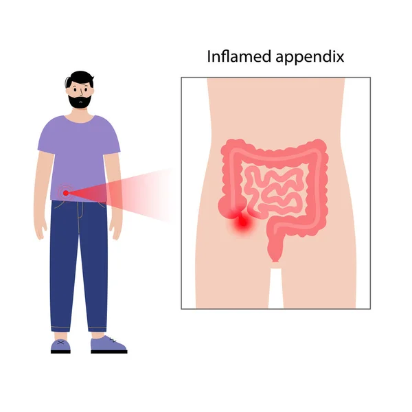 Apéndice concepto de dolor — Vector de stock