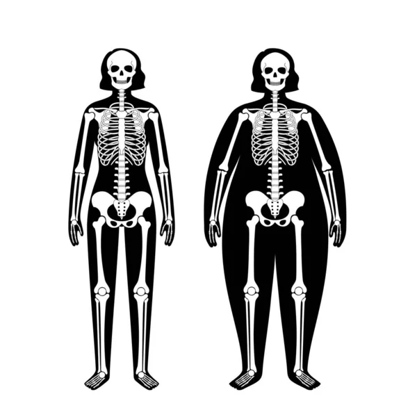 Obez iskelet anatomisi — Stok Vektör