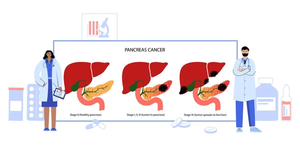 膵臓疾患とがん — ストックベクタ
